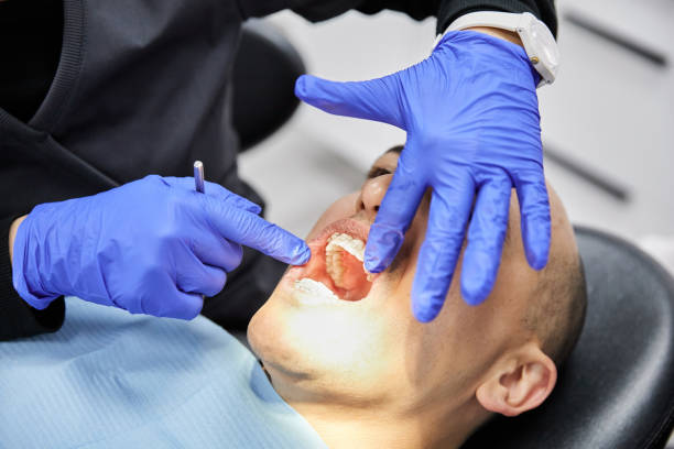 Best Emergency Dental Care for Abscessed Tooth in Clear Lake, IA
